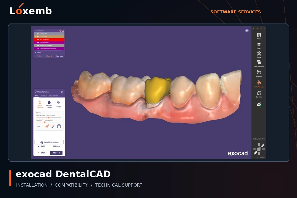 exocad DentalCAD software interface